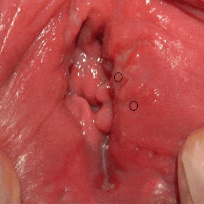 داخل واژن