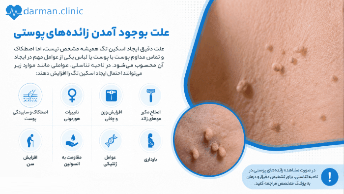 علت ایجاد اسکین تگ